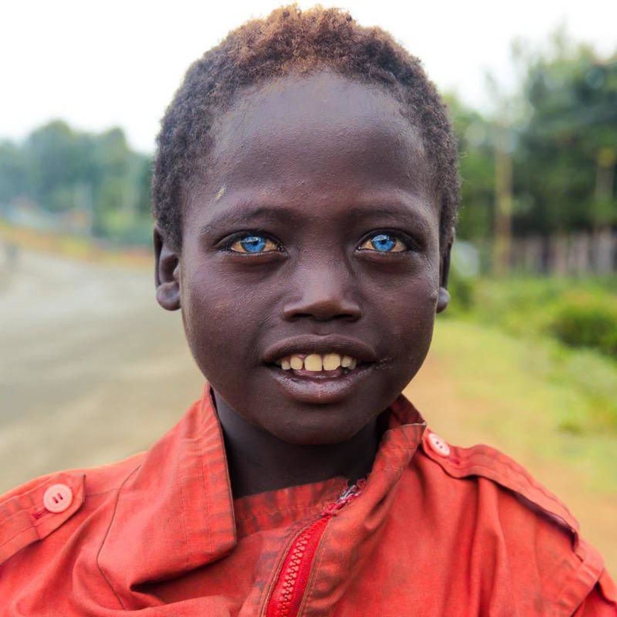 Африканка С Голубыми Глазами