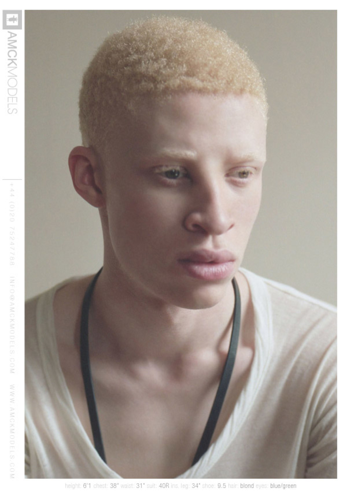 негр и азиат альбинос фото 21