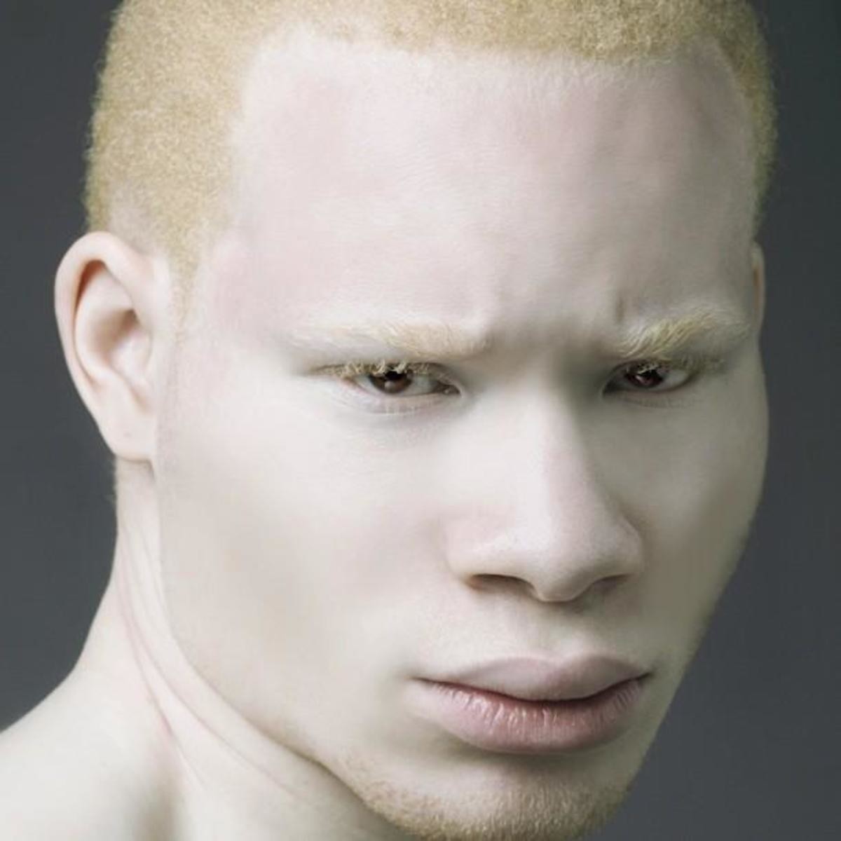 Albino black people. 