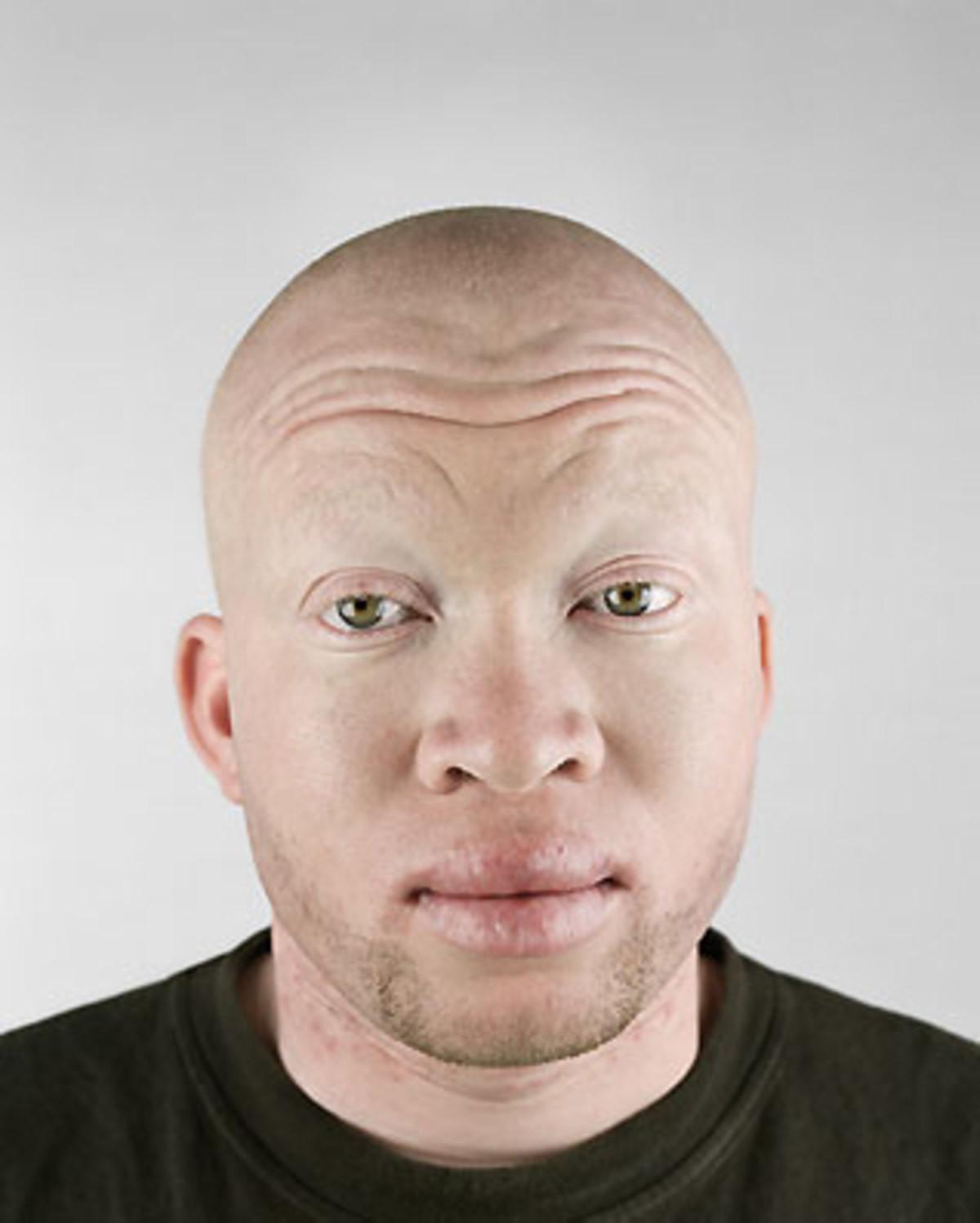 Albino black people.
