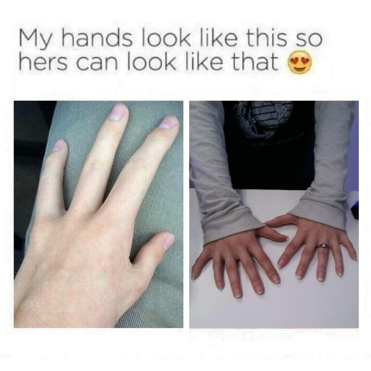 These are my hands. My hands look like this so her hands can look like that. My hands.