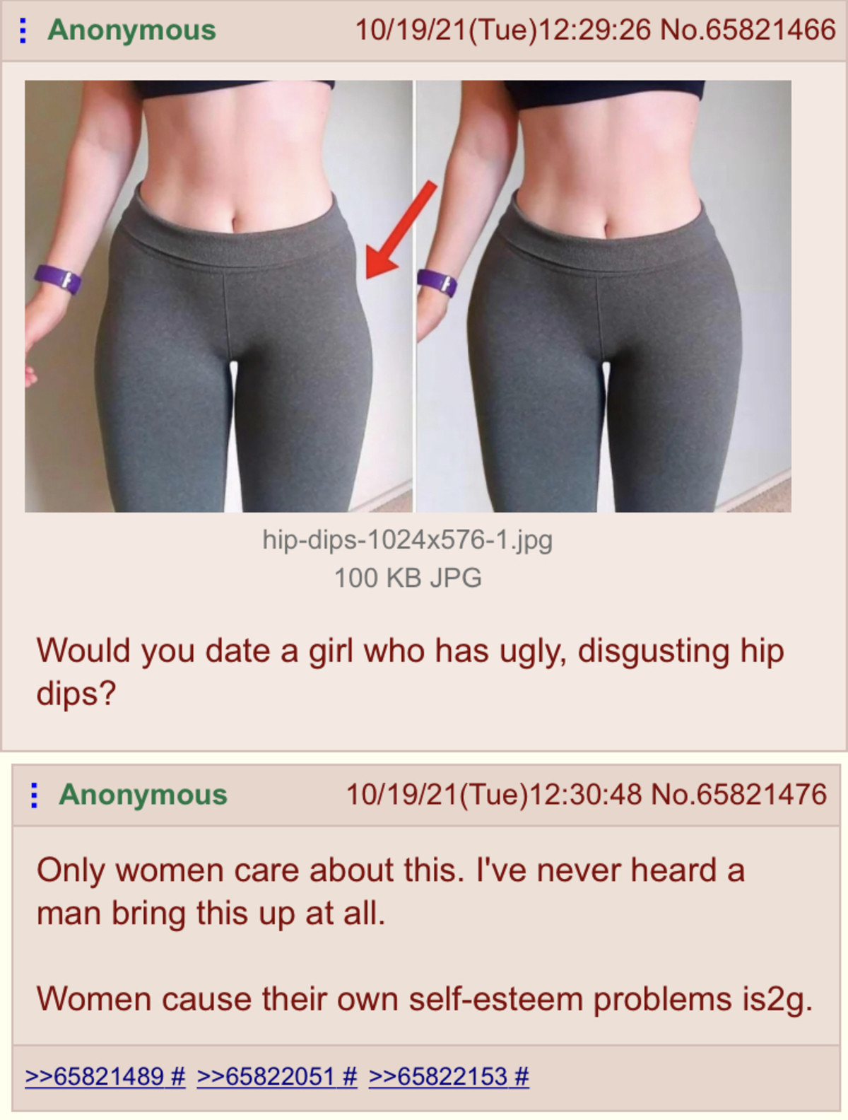 Are hip dips ugly