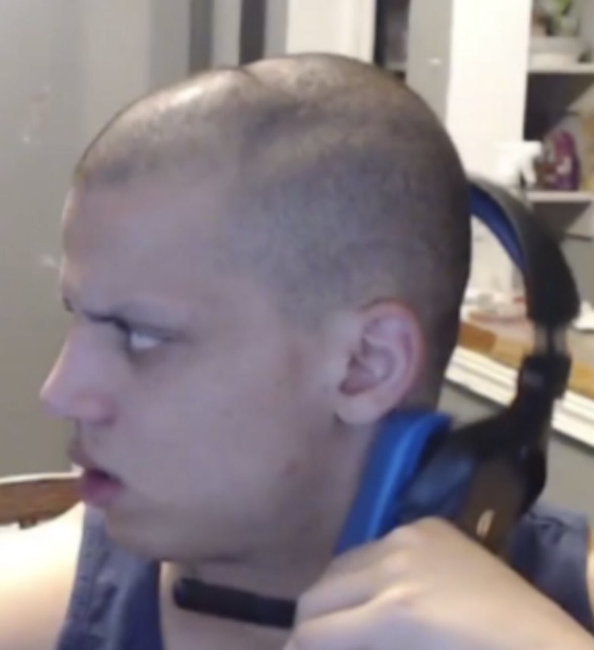 Tyler 1 headset dent