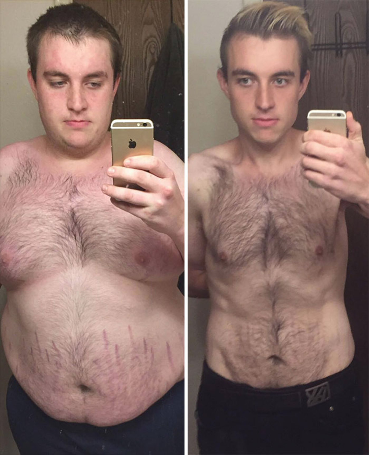 Мужчина после. До и после похудения мужчины. Мужское похудение до и после. Лицо после похудения мужчины. Лицо до и после похудения мужчины.