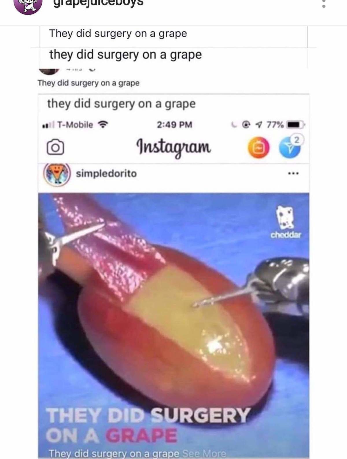 they did surgery on a grape they did surgery on a grape